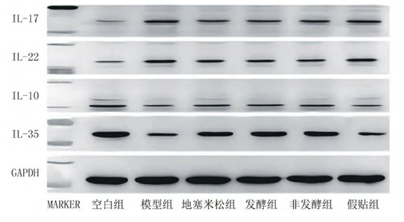 空白組和支氣管哮喘各組大鼠肺組織中IL－17、IL－22、IL－10、IL－35蛋白表達(dá)電泳圖